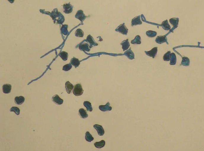 <p><b>Germinação in vitro de urediniosporos de Hemileia vastatrix.</b></p><p>Autor: Sylvia Dias Guzzo</p>